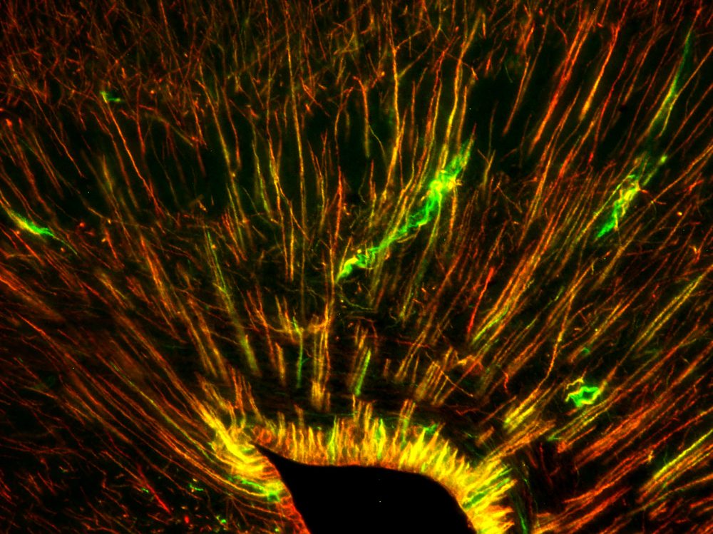 Stem cells in the gecko medial cortex. Looks like thin strings radiating out of central dark point