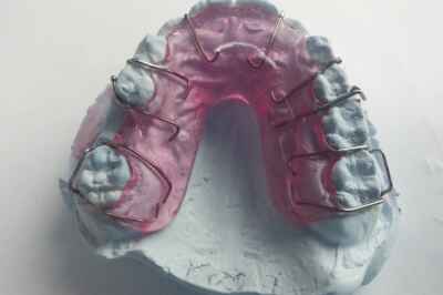How Did Orthodontists Sell Orthodontics?