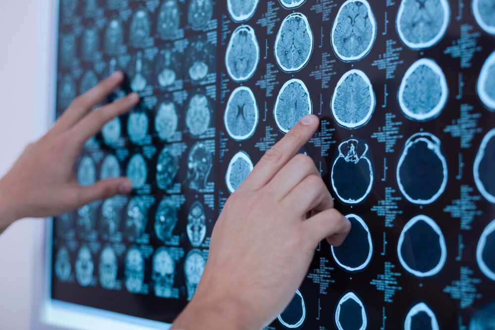 Left and right hands with multiple images of brain scans held against a wall
