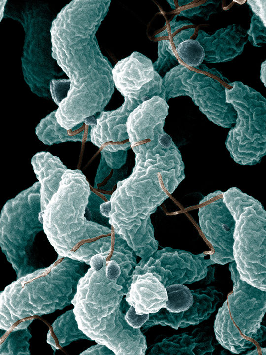 image shows artist rendering of campylobacter