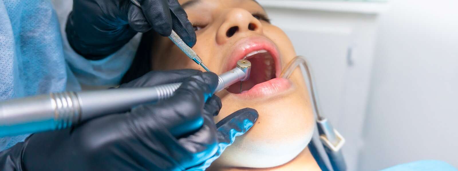 A patient gets dental treatment.