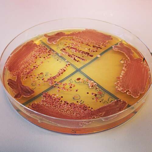 Red and yellow liquid with some spotted areas sits in a petri dish divided into four quadrants.