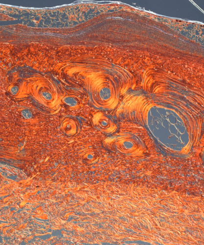 A research image in red, orange and gray depicts the osteoderm of an Australian shingleback lizard.