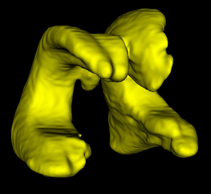 An image rendering of a brain's ventricles, two yellow moulds curl against a black background. Ridges can be seen on the moulds