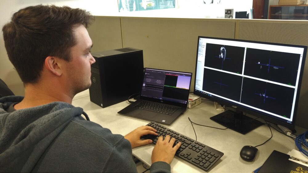 Over-the-shoulder shot of researcher, looking at a four-image spread of ultrasound imaging on a computer at their desk