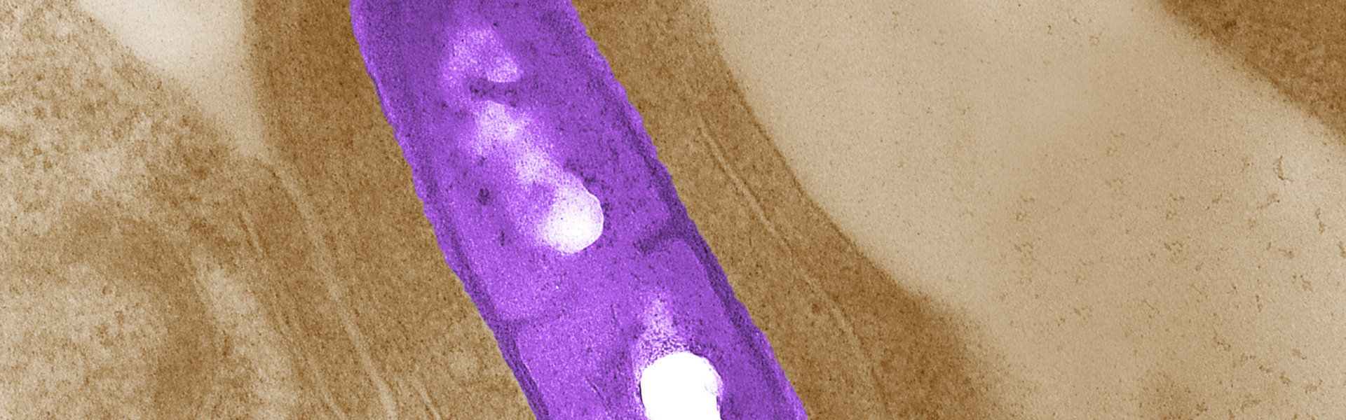 microscopic photo of a purple oblong listeria bacteria on a brown background