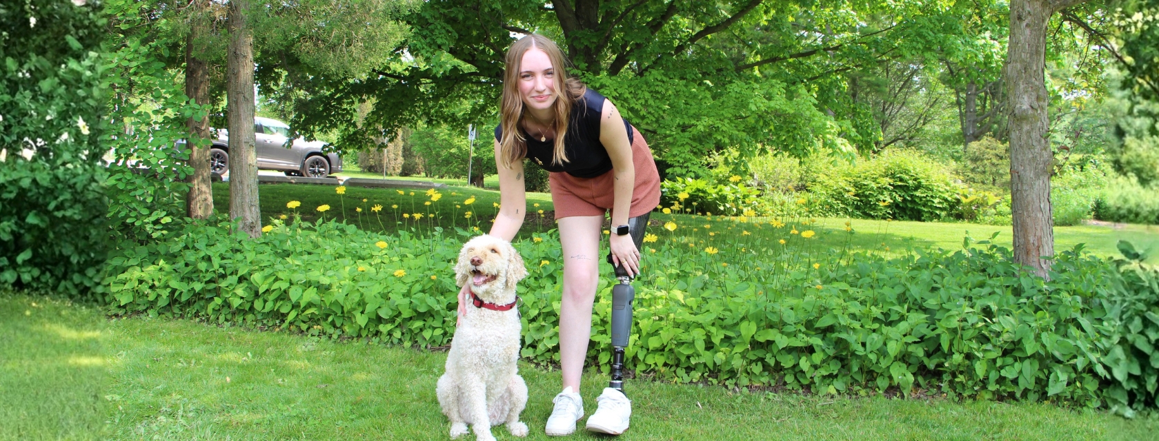 Person with prosthetic leg poses with dog against greenery