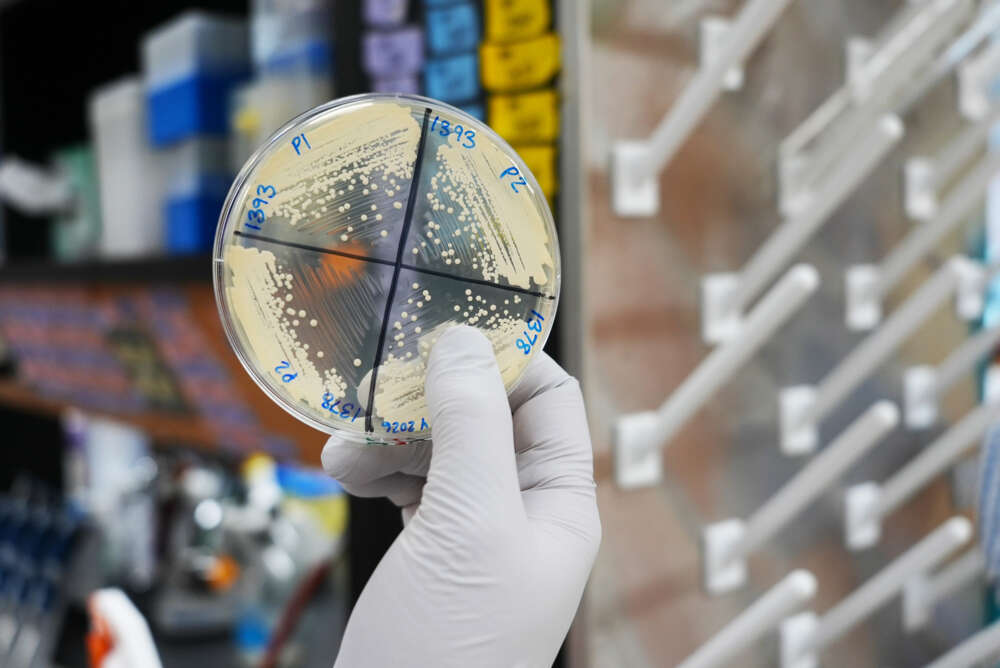 a gloved hands holds a petri dish of Candida cultures